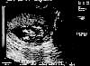 02-23-00_ultrasound.jpg