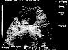 03-10-00_ultrasound.jpg